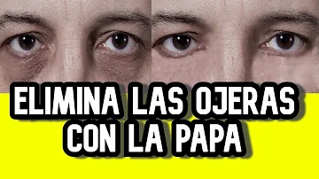 ¿La patata puede eliminar las ojeras?