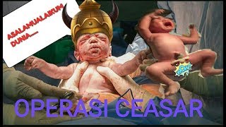 #Melahirkan Cesar || WELCOME THE WORLD BABY boy