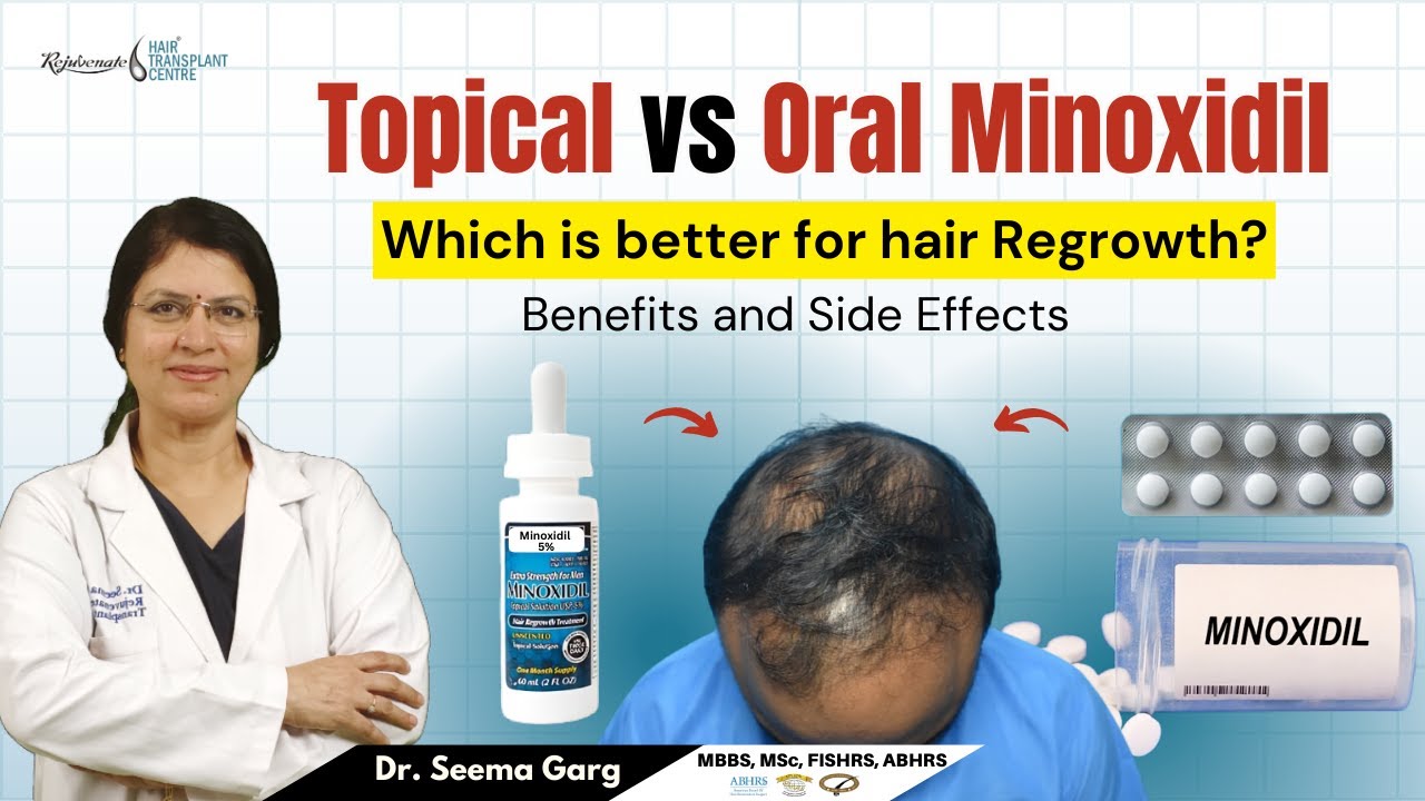 Topical vs Oral Minoxidil Which Is Best for Hair Regrowth? | Minoxidil for Hair Loss Topical or Oral