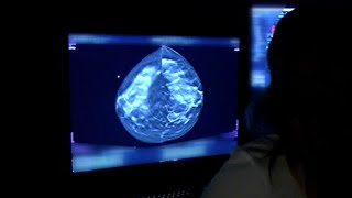 Buddy Check 3:  Customized program for people at high risk for breast cancer