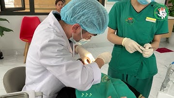 Cận cảnh quy trình nhổ răng khôn mọc lệch tại Nha Khoa Quang Hưng