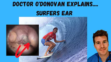 How do you know if you have surfer's ear?