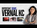 Important signs of Vernal KC - Nikmonic #neetpg