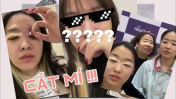 Mình đi cắt mí cùng cả nhà sau 7 năm nhấn mí | Quách Ánh