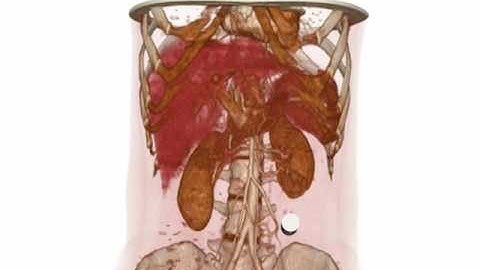 Interactive Multitactile Deformation Based On Homogeneization Method
