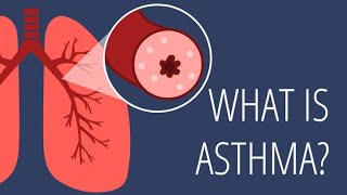 Lecture 62 # Respiration | Asthma, Bronchiectasis