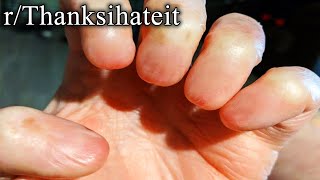r/TIHI | WHERE ARE YOUR FINGERNAILS?