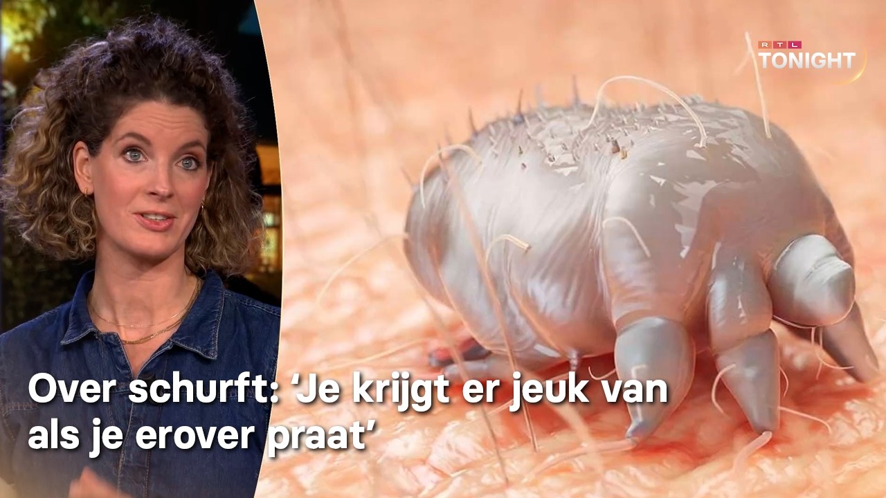 Zorgwekkende toename van schurft in Nederland | RTL Tonight