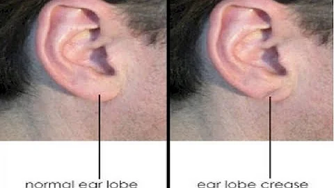 Having Hair In Your Ear  This Can Be A Warning Sign For Your Body!