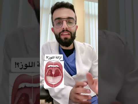 فيديو: هل يمكنك الحصول على نمو في اللوزتين؟