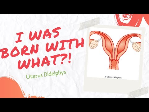 I Was Born with What? Uterus Didelphys | Dezi Does It