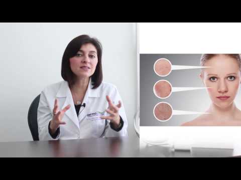 Video: ¿El ácido hialurónico provoca acné?