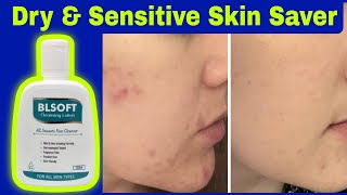 Blsoft Face Cleanser Lotion Review | Benefits, Usage & Honest Experience | Glowing Skin Tips#skin screenshot 3