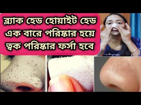 ভিডিও: মাইক্রোডার্মাব্রাশনের পরে আপনার ত্বকের যত্ন নেওয়ার 3 টি উপায়