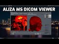 Aliza MS DICOM Viewer