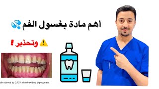 ✅غسول الفم لنزيف اللثة ?لرائحة الفم الكريهة ?