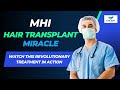 Mhi hair transplant miracle watch this revolutionary treatment in action  hair transplant