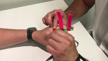 Volar Finger Trough by ATS (short version without sound)