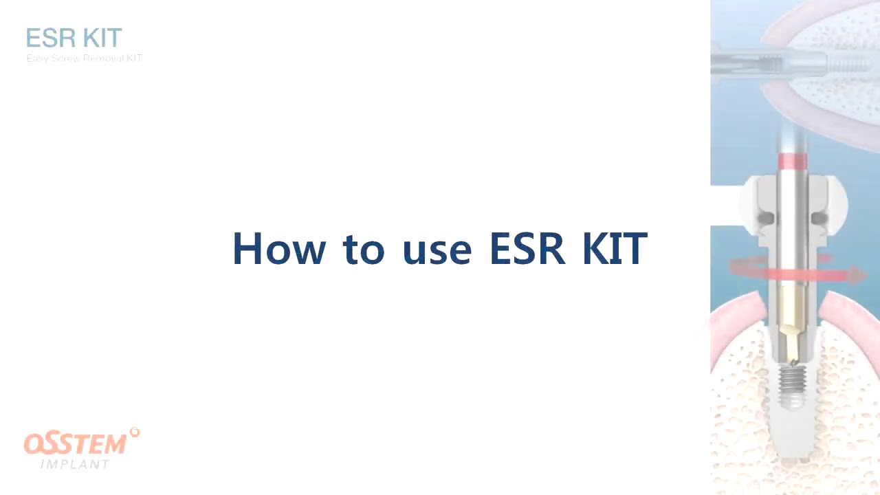 Osstem ESR Kit (Easy Screw Removal) YouTube