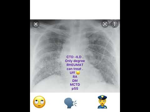 Lung ? in rheumatology. Only #degree RHEUMAT can treat ! Mind it ???