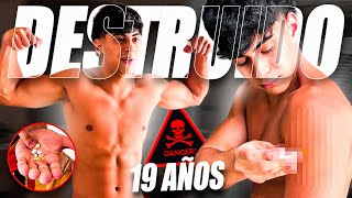 THIS IS HOW A LIFE IS DESTROYED AT 19 💉 THE REALITY of Steroids screenshot 1