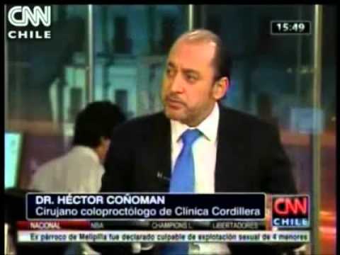 Entrevista Dr. Héctor Coñoman: Transito Lento CNN Chile ...