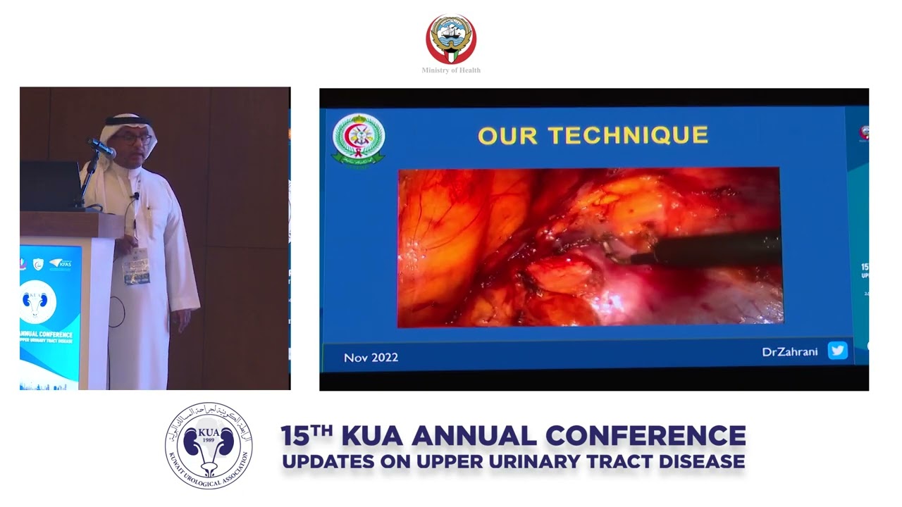Operative Management? - Laparoscopic donor nephrectomy: tips & tricks - Dr. Ahmad Alzahrani