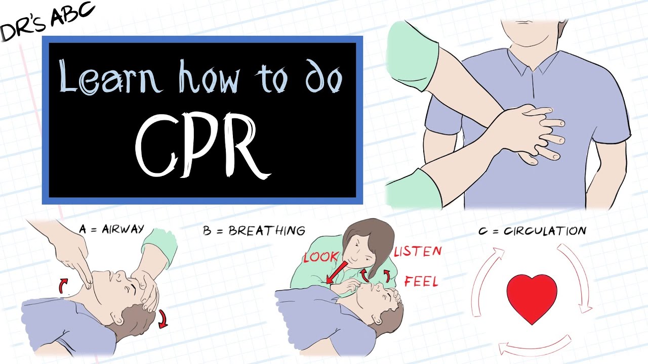 Proper techniques for chest compression. Illustration about emergency help  and perform CPR. First aid for person has stopped breathing. Stock Vector