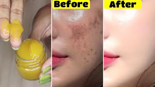 Apply this??Turmeric Gel for 7 Days and see what happens-No Spots and Dark Skin-Get Light Fair Skin