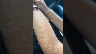 Woman With BLONDE Very Hairy ARMS