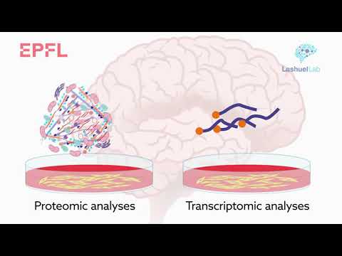 Video: Lewy Body Dementia: Årsager, Behandling Og Mere