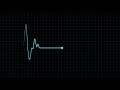 HEART beat line overlay Pulse ECG Monitor FREE footage + sound effect