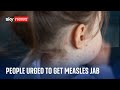 &#39;National incident&#39; declared over measles outbreak