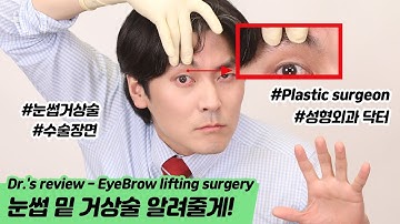 눈처짐 치료법 - 성형외과 전문의가 알려줄게