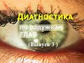 (Вып. 3) Диагностика по радужкам глаз