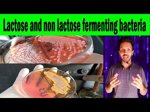 Lactose and non lactose fermenting bacteria | MacConkey agar (Clear explanation)