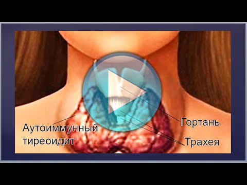 Video: Palpácia štítnej žľazy