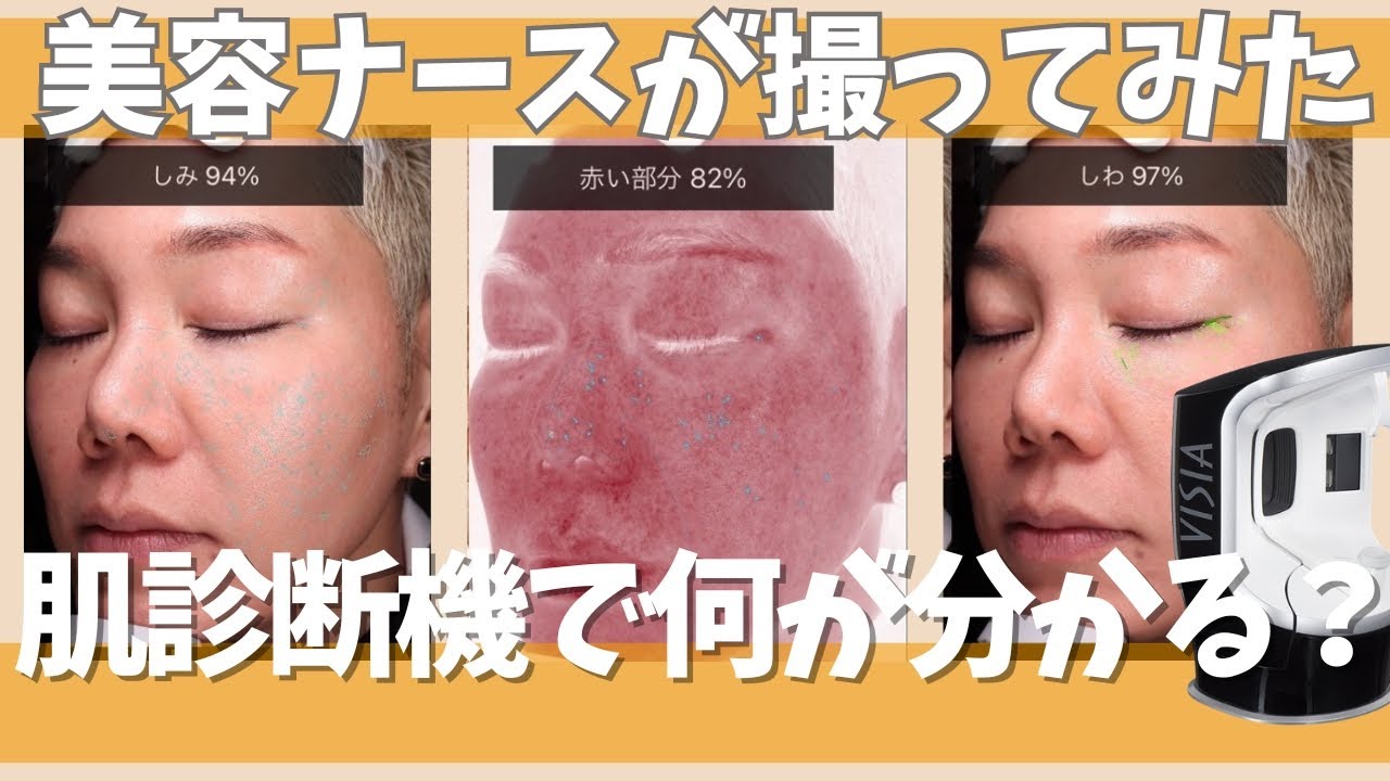 【肌診断機】美容ナースが撮ってみた！VISIAで何が分かるの？