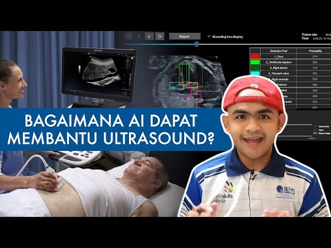 Video: Bagaimana Mempersiapkan Anak Untuk Ultrasound Otak