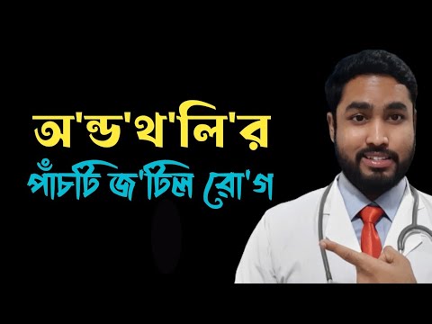 ভিডিও: প্রস্থেসিস পরার 4 টি উপায়