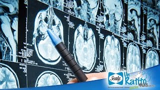 Diferencias entre los trastornos psiquiátricos y neurológicos