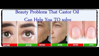 Beauty Problems That Castor Oil Can Help You Solve..العيوب التى يمكن لزيت الخروع ان يحلها فى بشرتك