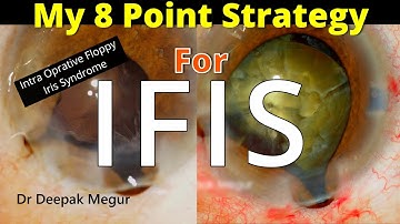 My 8 point strategy to deal with IFIS - Dr Deepak Megur