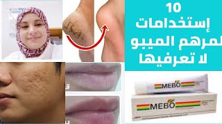 ترطيب الشفايف    مرطب للبشرة الدهنية   تشققات الكعبين  10  استخدامات مزهلة لمرهم الميبو تعرفي عليها