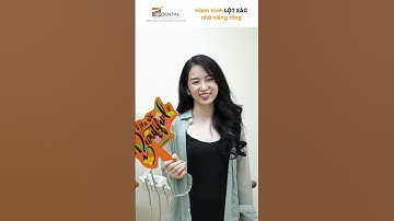 Hành trình LỘT XÁC nhờ niềng răng của Thanh Trà