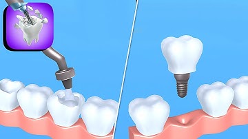 TeethDoc ​- All Levels Gameplay Android,ios (Levels 14-16)