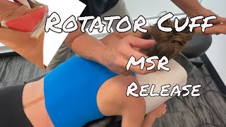 Rotator Cuff Release - MSR