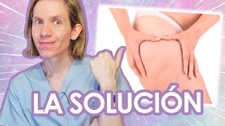 CELULITIS: COMO PREVENIRLA y ELIMINARLA - Simon Scarano Dermatologo