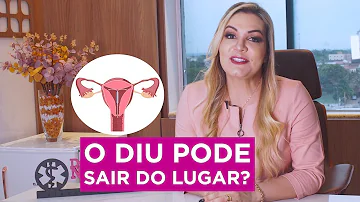 O que pode deslocar o DIU?