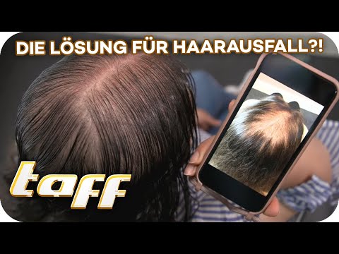 Kein Haarausfall mehr! Neue Haar-Wachstumsbehandlung? | taff | ProSieben